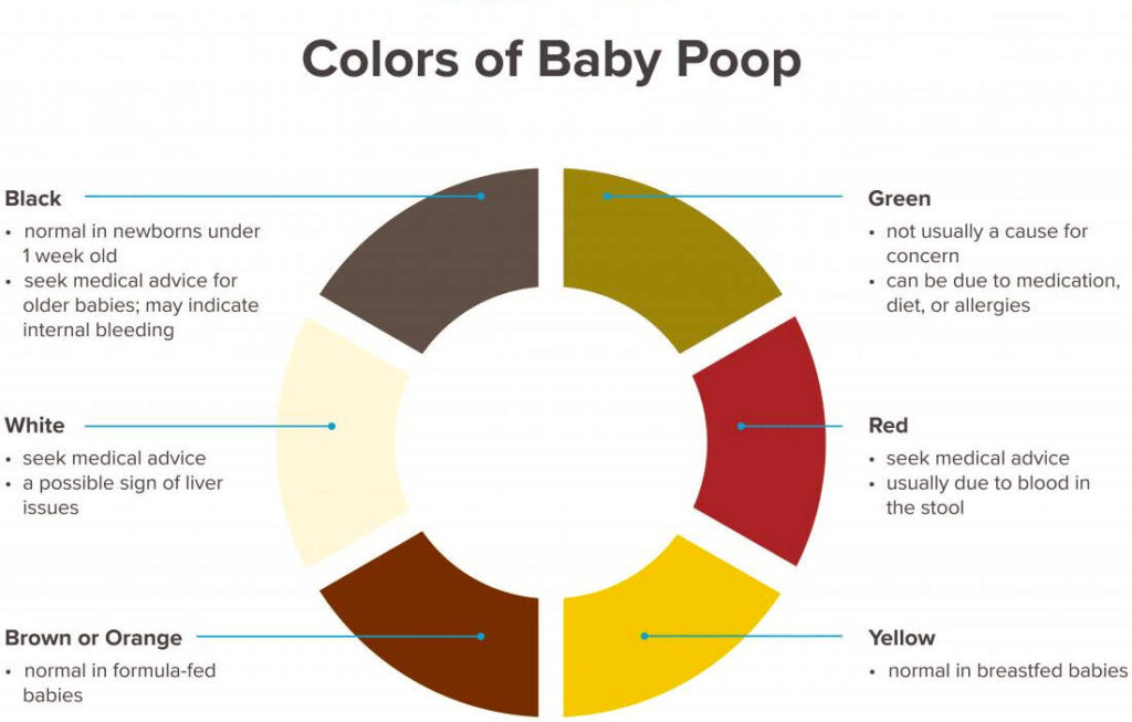 Baby Poop Color Chart: The Complete Guide to Understanding Baby Poop ...